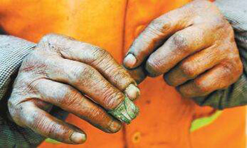 環(huán)衛(wèi)的辛苦看看他們的雙手就知道 環(huán)衛(wèi)的辛苦看看他們的雙手就知道